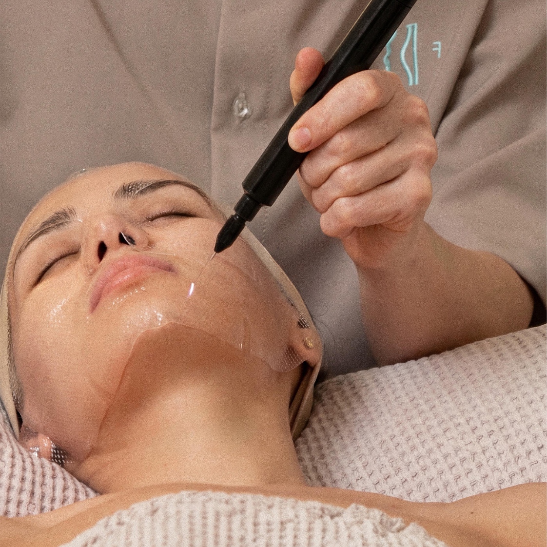 Новая услуга Холодная плазма в FaceRoom!